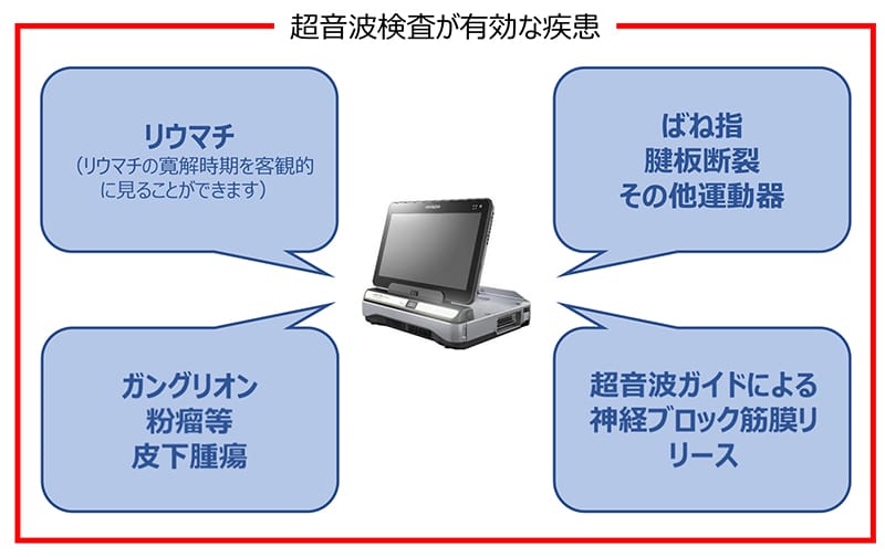 超音波検査が有効な疾患